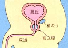 前立腺炎とは?